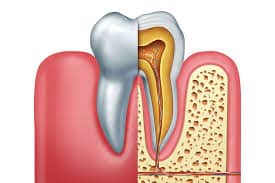 Periodontics